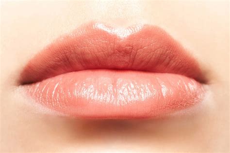Best Treatment For Vertical Lines Around Lips