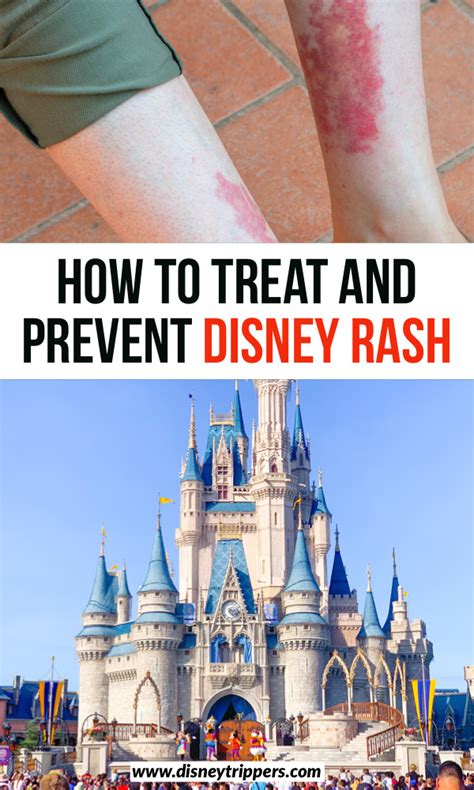 How To Treat And Prevent Disney Rash Disney Trippers Disney Trip