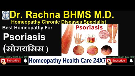 Best Homeopathy Medicines For Psoriasis Youtube