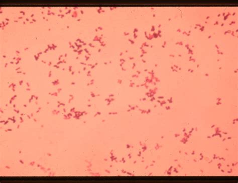 B550 1 Listeria Monocytogenes Gram Stain From Bhi Broth A Flickr