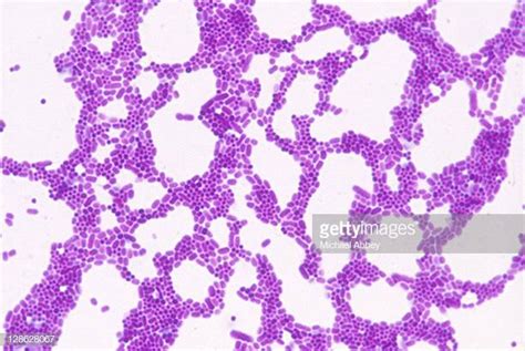 Gram Negative Bacteria Stock Photos And Pictures Getty Images