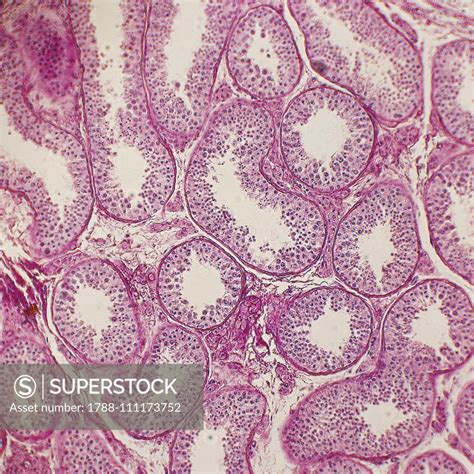 histological slide of human testis seen under a microscope at x100 magnification superstock
