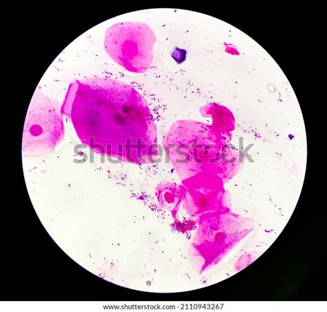 Sputum Gram Stain Microscopic View Show Stock Photo 2110943267