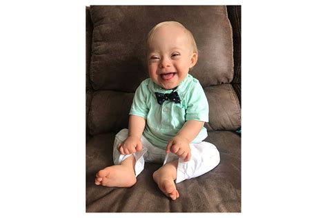 Babies with down syndrome have an extra copy of one of these chromosomes, chromosome 21. Boy Makes History as Gerber's First Spokes-Baby With Down's