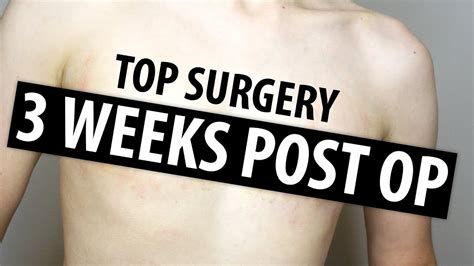 3 weeks post op dr garramone nonbinary top surgery youtube