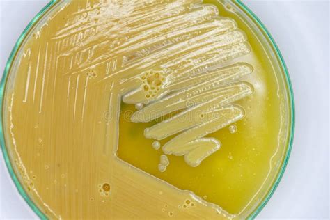 Characteristics And Different Shaped Colony Of Bacteria And Mold