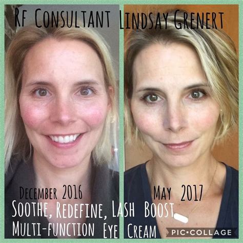 Rodan Fields Soothe Has Amazing Results For Sensitive Skin