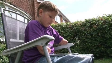 Boy With No Arms Or Legs Told He Must Prove He Is Disabled To Keep Benefits