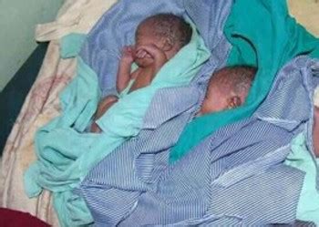 Baby Rescued From Pit Latrine In Aweil Radio Tamazuj