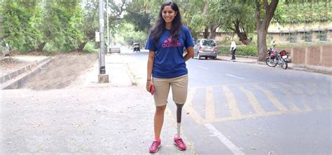 She Lost A Leg In An Accident Instead Of Giving Up She Accepted Her