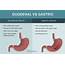 Dyspepsia 8 Strategies To Improve Indigestion  DrJockerscom