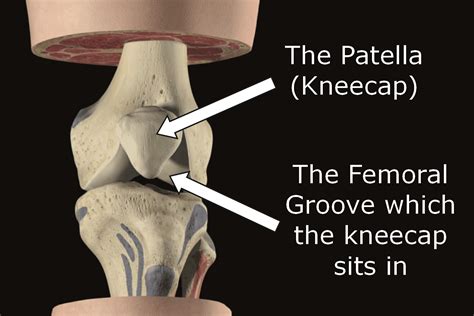 Knee Pain Solutions To Common Problems Dannywallispt