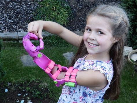 Inventor Makes Cool Prosthetic Limbs For Kids In His Garden Shed For Free
