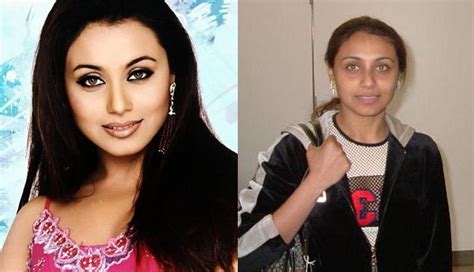 Shocking Photos Of Bollywood Actresses Before And After Plastic Surgery