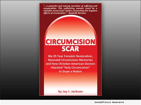 Circumcision Scar Is A New Memoir Revealing How The Worlds Oldest