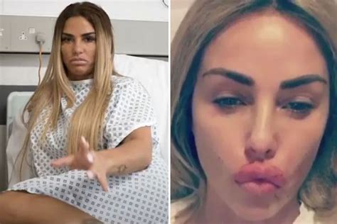 katie price says her boobs were deformed as she opens up about surgery regrets over botched