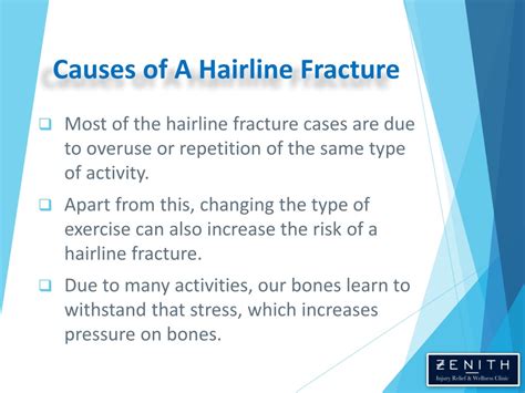 Ppt Hairline Fracture Causes Symptoms And Treatment Powerpoint