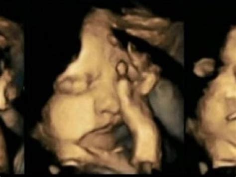 fetuses reacting to moms smoking