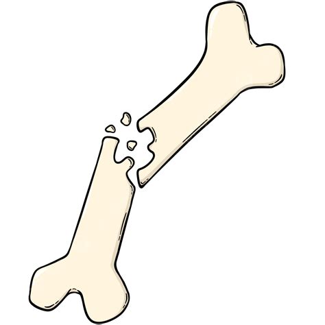 Broken Bones Bone Bone Broken Medical Png Transparent Clipart Image