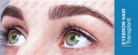 Some have thin eyebrows while others have thick ones. Eyebrow Hair Transplant | Basir Health Tourism Holding