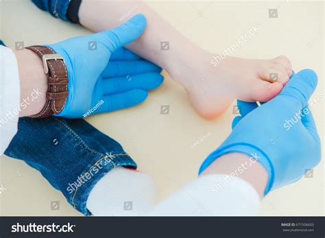 Child Joint Dislocation Luxation Healing Foot库存照片671506603 Shutterstock
