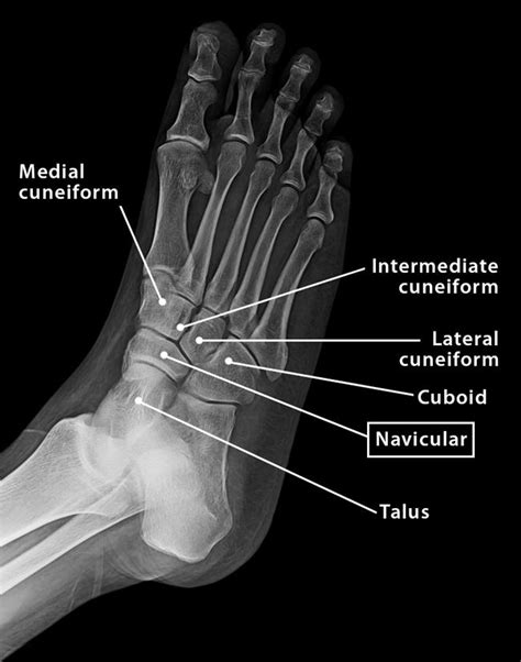 Navicular Bone Location Anatomy And Labeled Diagram