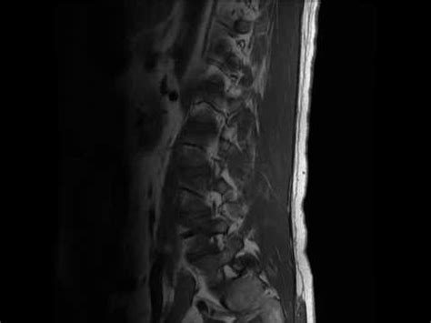 They also have more access to resources and databases than you and can certainly be datingcritic editors check all the services that dating sites provide and honestly tell what they liked and what did not. MRI SCAN LAYERS can you tell whats wrong?? - YouTube