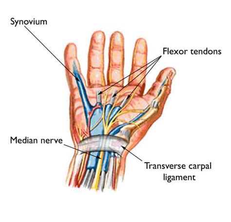 Carpal Tunnel Syndrome Teton Hand Surgery