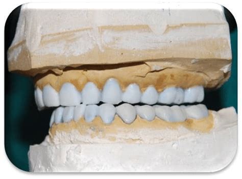 Webinar functional occlusion in the digital age part 1 with al fillastre cdt. Group Function occlusion | Download Scientific Diagram