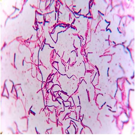 Solved Gram Positive Bacillus Cereus Aerobic Micrococcus Luteus The Best Porn Website