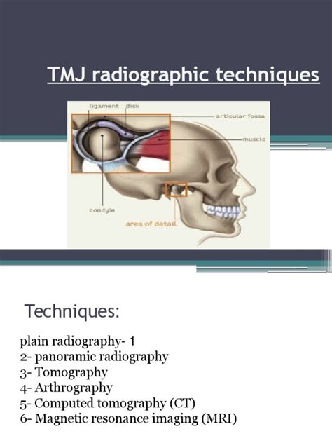 Tmj Imaging Techniques Pdf Ct Scan Medical Imaging