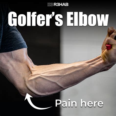 Golfers Elbow E3 Rehab