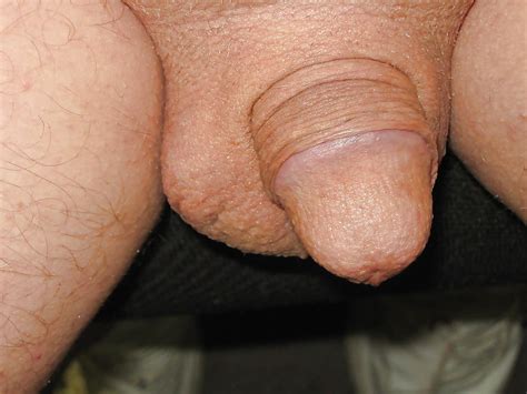Midget Penis Pics XHamster