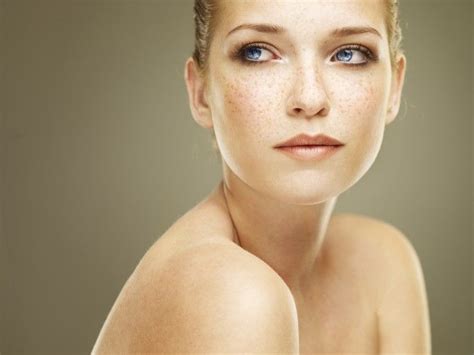 Treating Freckles With Ipl Therapy Treatments Seamist Medspa