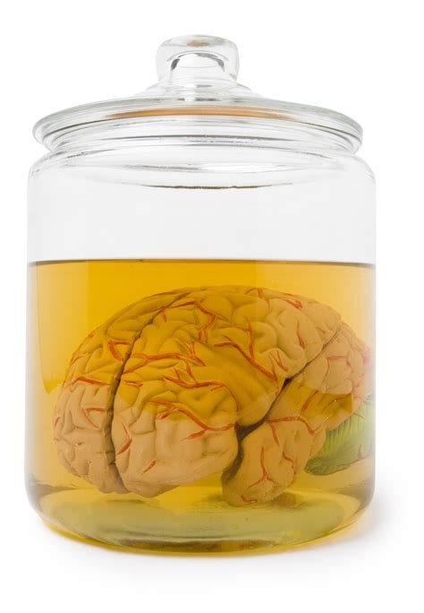 100 Human Brains Went Missing From The University Of Texas