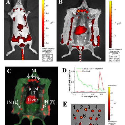 Fluorescence Imaging Of Lymphatic Basins In Mice By Tail Vein