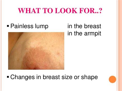 Armpit Cancer Lump