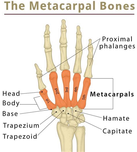 Metacarpal Fracture Causes Symptoms Diagnosis And Treatment