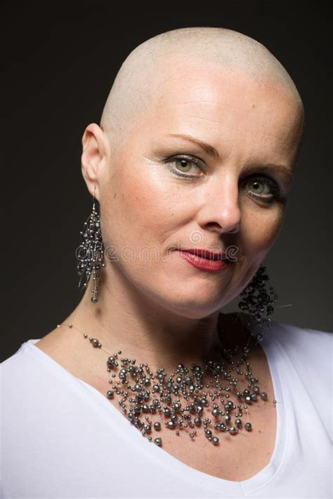 Beautiful Woman Cancer Patient Without Hair Stock Image Image Of