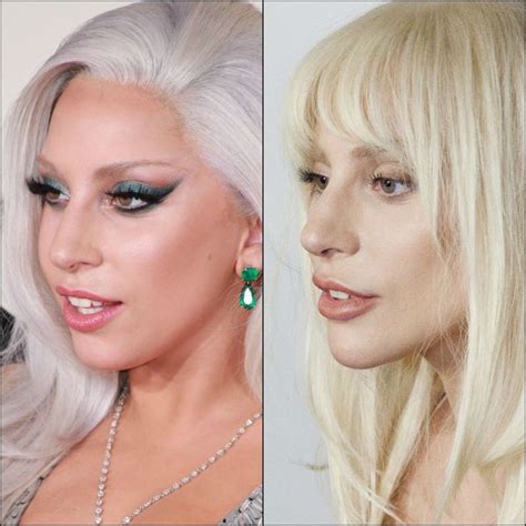 Pin By Laura Gonzalez On Lady Gaga In 2024 Lady Gaga Plastic Surgery Lady Gaga Nose Plastic