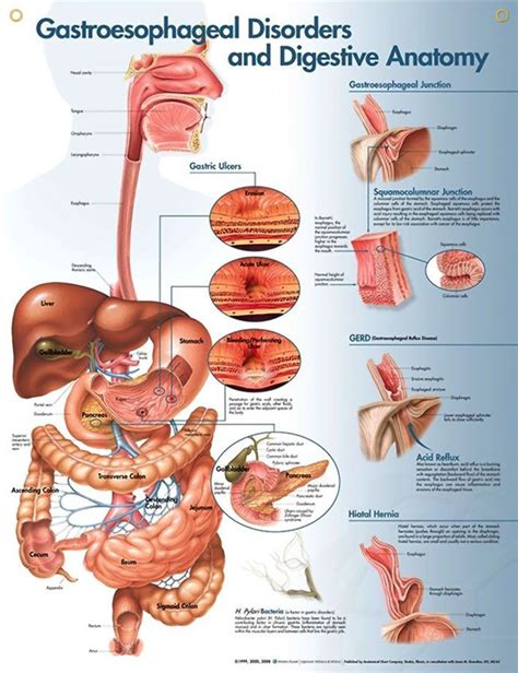 Gastroesophageal Disorders Anatomy Poster Illustrates Digestive Anatomy And Disorders Like