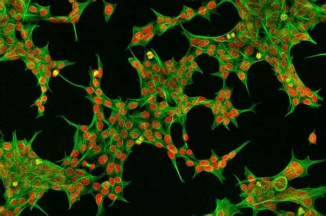 Once injected into humans, this program is carried. Does the Origin of the Fetal Cells Used for Developing ...