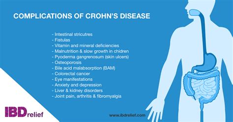 Complications Of Crohns Disease Ibdrelief