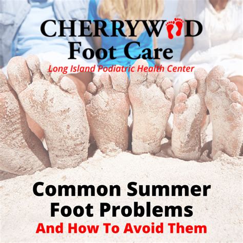 Common Summer Foot Problems And How To Avoid Them Cherrywood Foot Care