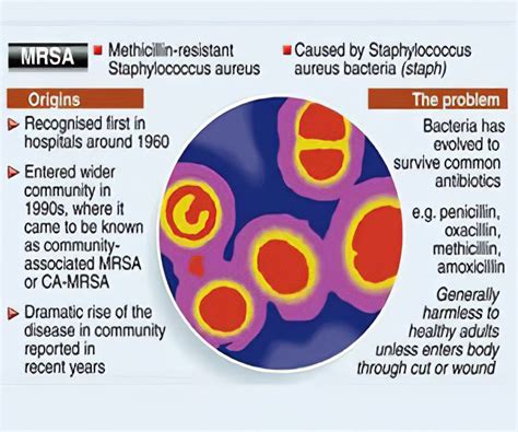 Staphylococcus Aureus Infection Symptoms