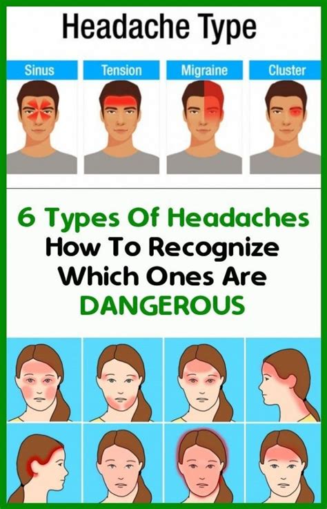6 Headaches Types How To Identify Who Is Dangerous Headache Types