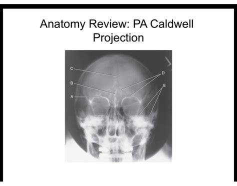 Pa Caldwell Projection Skull