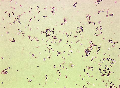 Gram Positive Rods In Sputum Submited Images