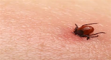 Lone Star Tick Bites Can Make You Allergic To Meat