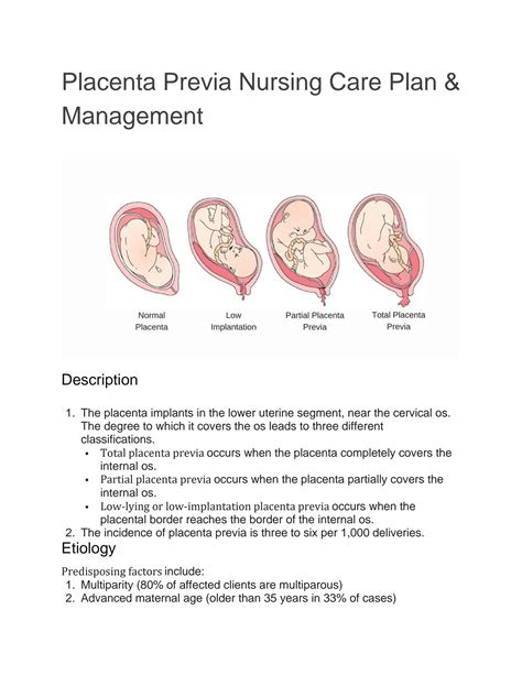 Placenta Previa Nursing Care Plan And Management Porn Sex Picture